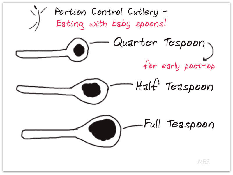 Portion Control Cutlery Guide After Weight Loss Surgery