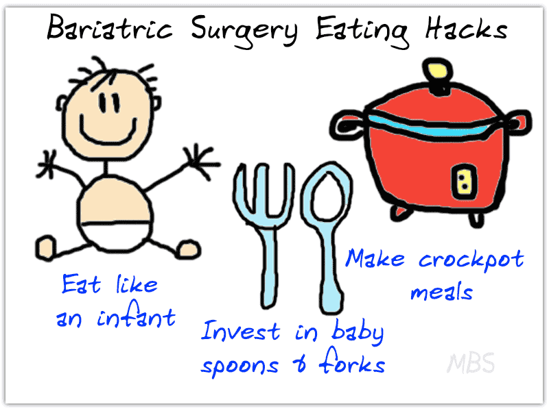 Eating A Few Weeks After Bariatric Surgery