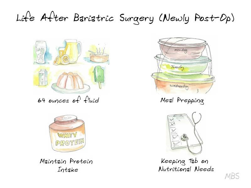 Weight Maintenance After Bariatric Surgery