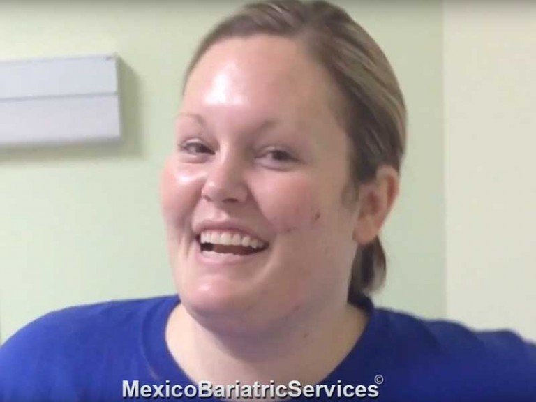 Lorissa on her Gastric Sleeve in Tijuana