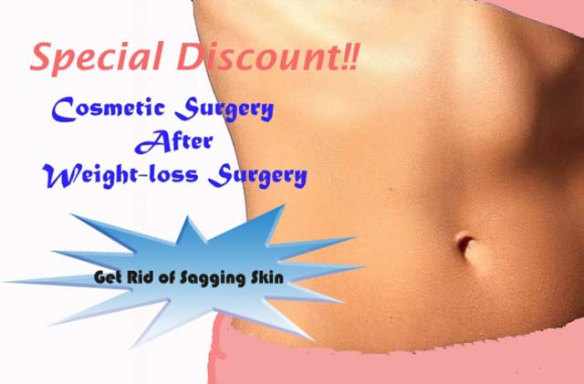 discount