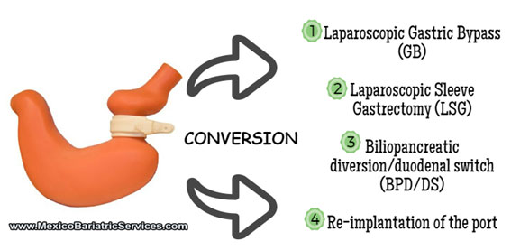 Lap Band Revision Options in Mexico