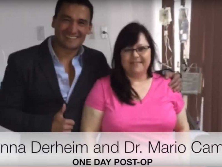 Gastric Sleeve Patient Testimonial – Tijuana, Mx