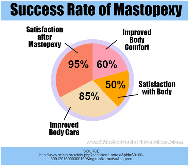 Mastopexy Statistics - Infographic