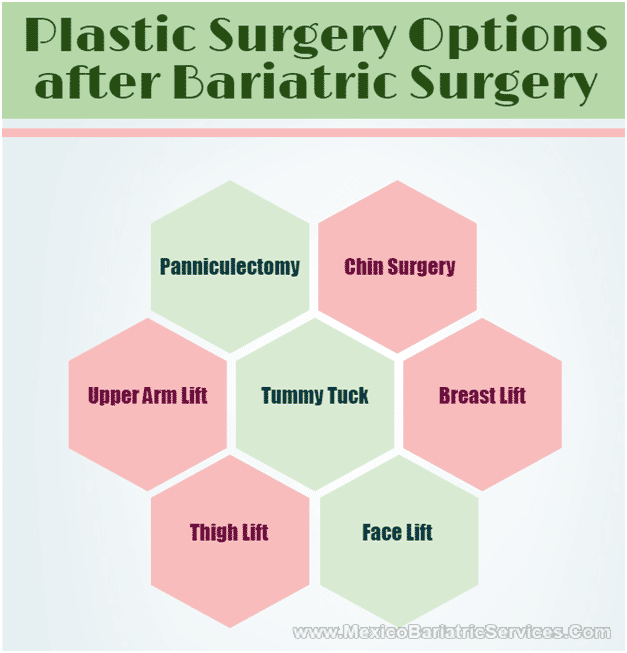 Plastic Surgery Options After Bariatric Surgery