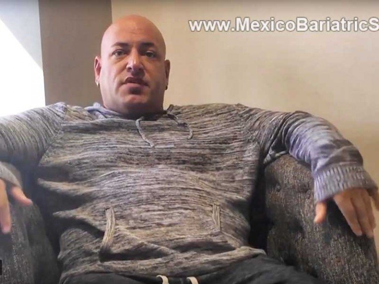 Sleeve Gastrectomy in Tijuana, Mexico – Kirk’s Review