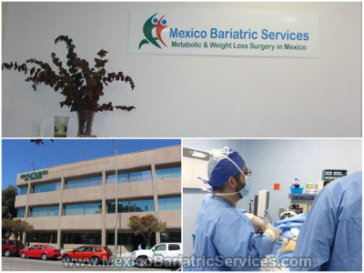 Bariatric Surgery in Mexico