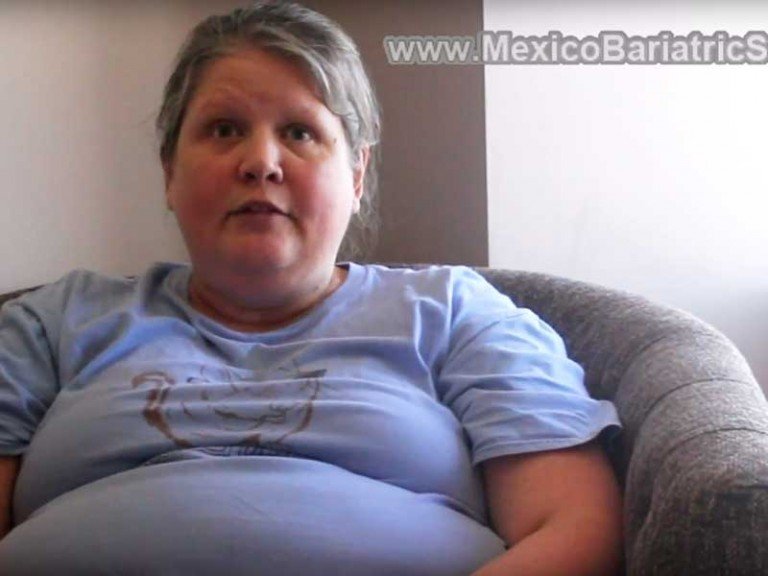 Testimonial on Gastric Sleeve Mexico by Gina Adams