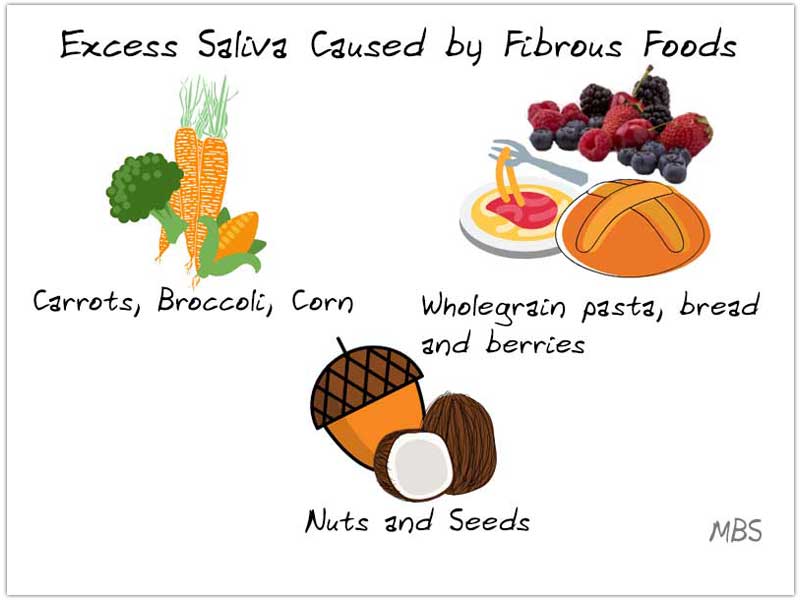 Fibrous Food Causing Excess Saliva Post Gastric Sleeve Surgery