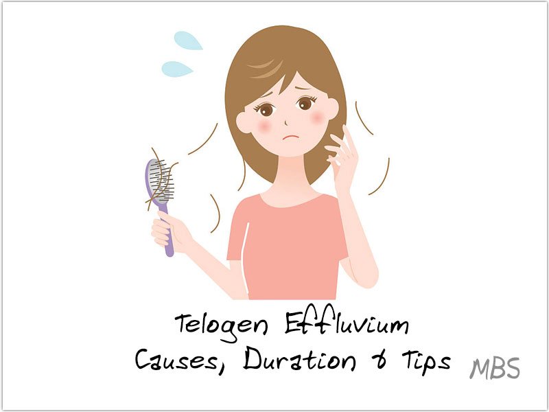 Telogen Effluvium Causes and Tips