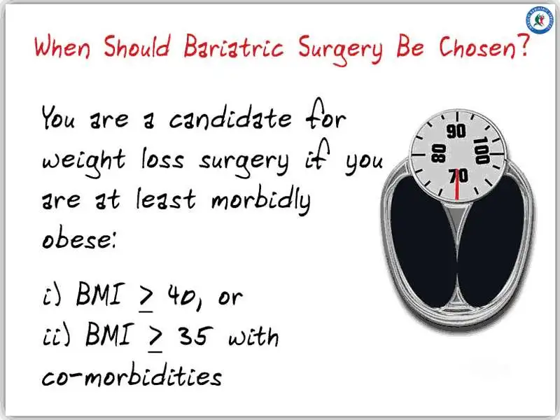 Choosing Weight Loss Surgery