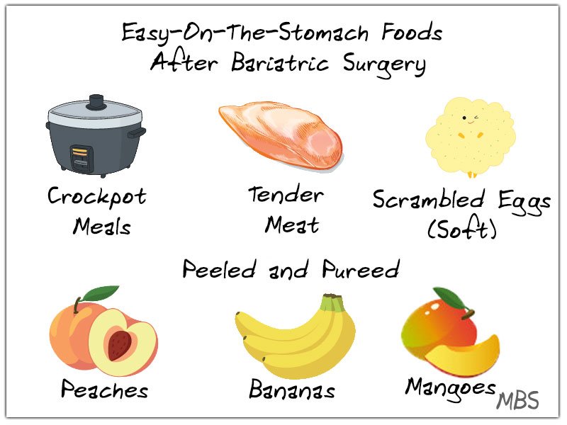 Week-4 Post Bariatric Surgery Instructions