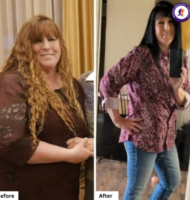 Gastric Bypass in Tijuana: Affordable and Safe! Before and after pictures of Wendy Medrano from Idaho, USA, after weight loss surgery in Tijuana