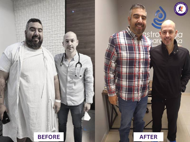 Dr. Cristóbal Garza Before and After