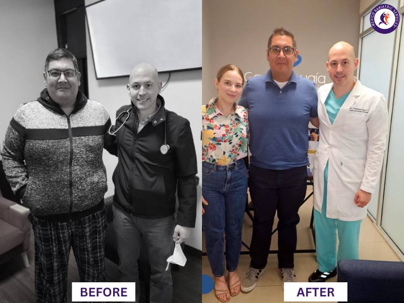 Dr. Cristóbal Garza Before and After