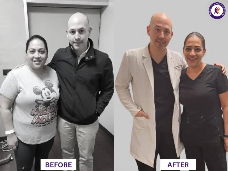 Dr. Cristóbal Garza Before and After