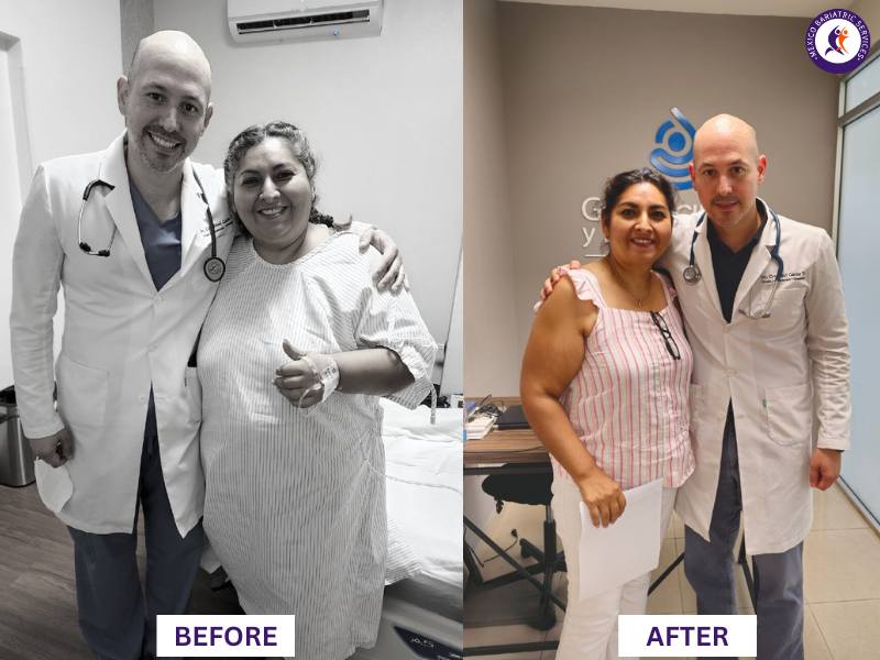 Dr. Cristóbal Garza Before and After