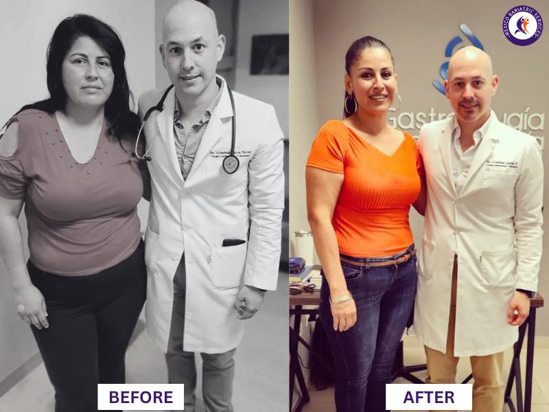 Dr. Cristóbal Garza Before and After