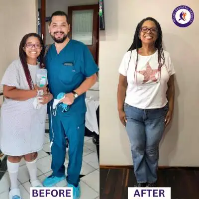Weight Loss Surgery, Before & After Before & After